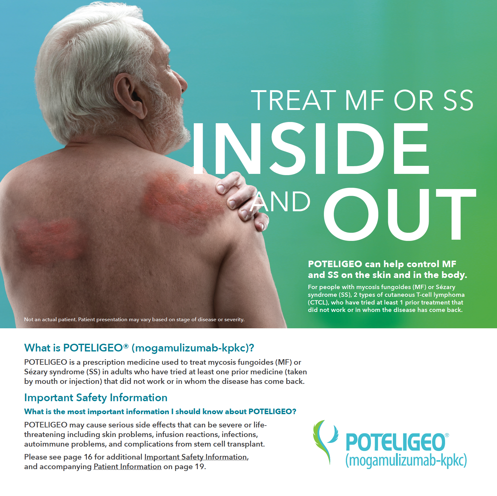 POTELIGEO Patient brochure thumbnail